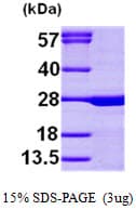 Human SLC9A1BP / CHP Protein (Recombinant His)