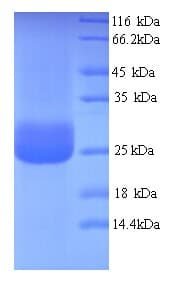 Human CD300LF / CD300f Protein (Recombinant 6His, N-terminus)