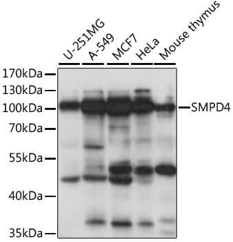 SMPD4 Antibody