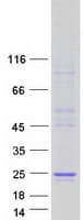 Human FEV / PET1 Protein (Recombinant Myc-DDK (Flag))