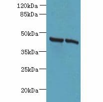 HSDL2 Antibody