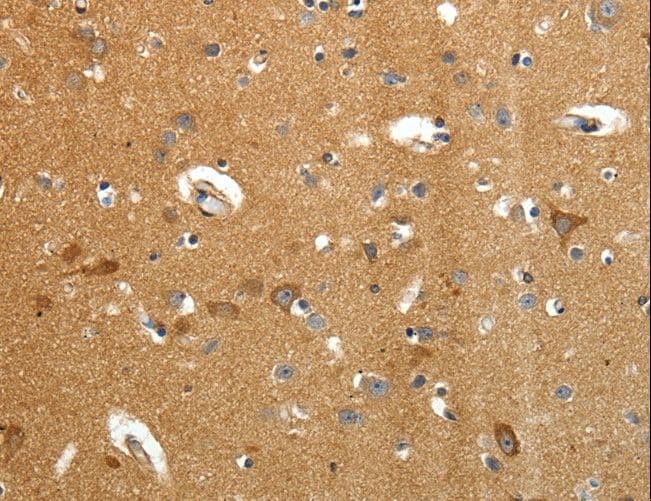 Polyclonal Rabbit anti-Human AMD / AMD1 Antibody (IHC)