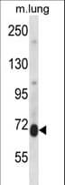 PRKCD / PKC-Delta Antibody (aa38-67)