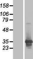 LASP1 Protein (Over-Expression Lysate Myc-DDK (Flag))