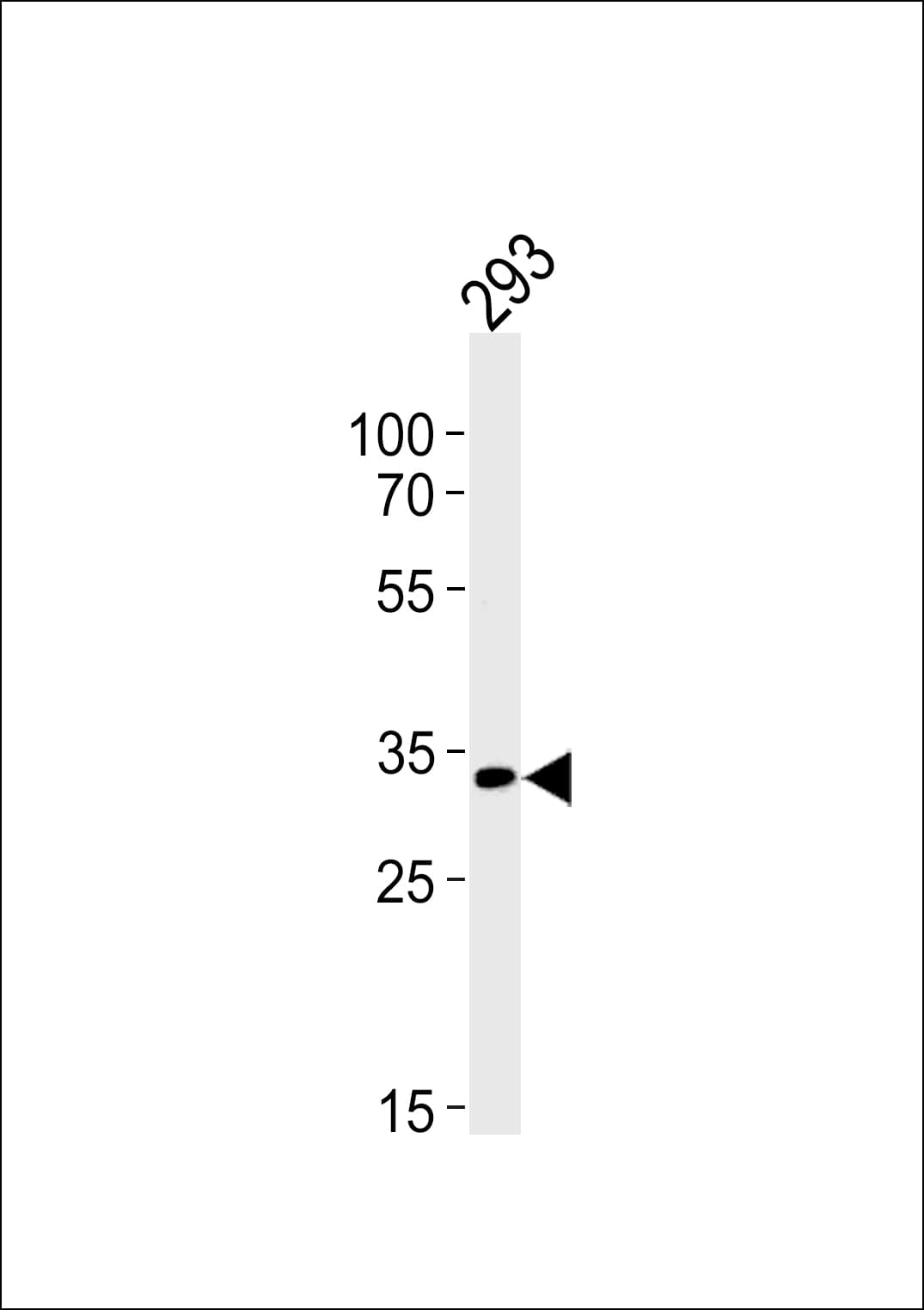 Polyclonal Rabbit anti-Human STUB1 / CHIP Antibody (aa203-231, IHC, WB)