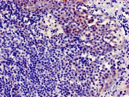 Polyclonal Rabbit anti-Human CCR7 Antibody (IHC, IF)