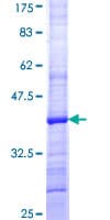 Human HGF / Hepatocyte Growth Factor Protein (Recombinant GST, N-terminus)