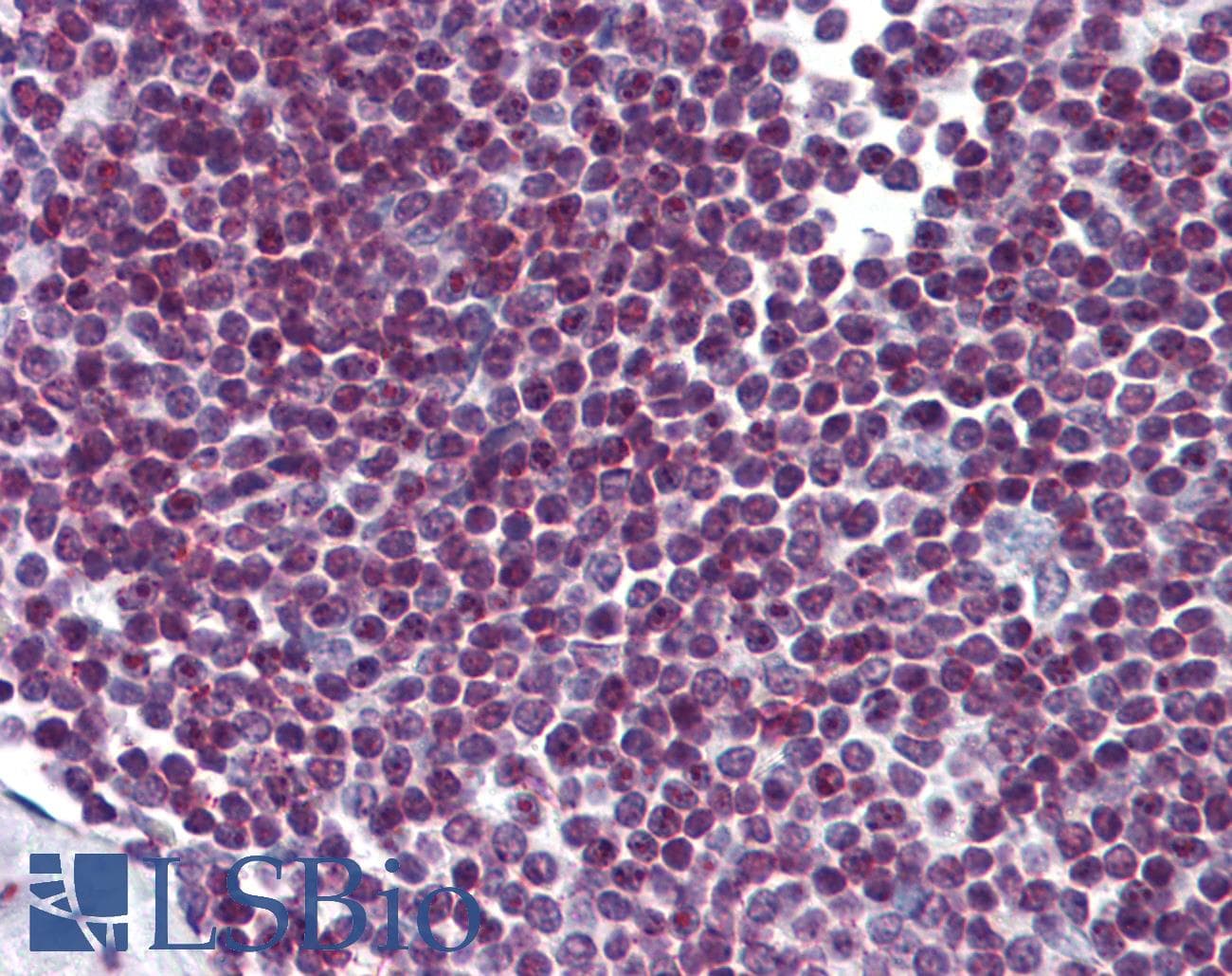 IHC-plus™ FOXO3 / FOXO3A Antibody (clone 3C2)