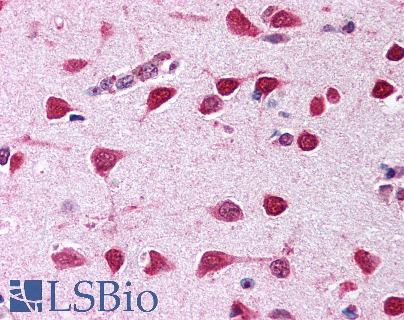 IHC-plus™ CELF1 / CUGBP1 Antibody (clone 3B1)
