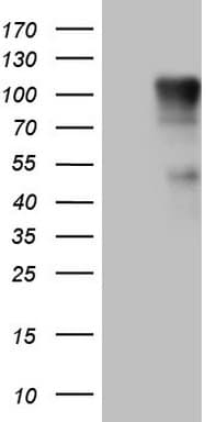 Monoclonal Mouse anti-Human FSIP1 Antibody (clone OTI3E6, WB)