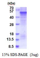 Human SPRED1 Protein (Recombinant His)