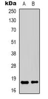 Polyclonal Rabbit anti-Human TCEAL1 Antibody (Internal, IHC, IF, WB)