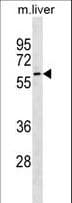 GNL3 / NS / Nucleostemin Antibody (aa442-471)