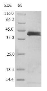 Human IL36A Protein (Recombinant GST, N-terminus)