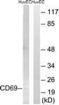 CD69 Antibody (aa101-150)
