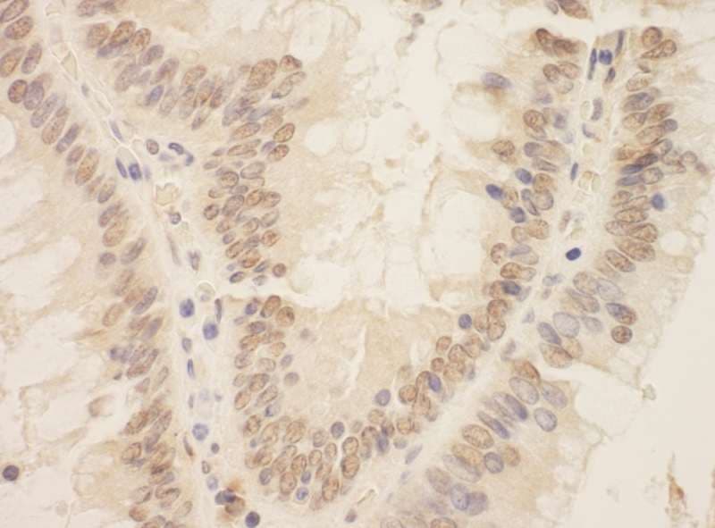 Polyclonal Rabbit anti-Human ZEB2 / SIP-1 Antibody (aa1164-1214, IHC, WB)