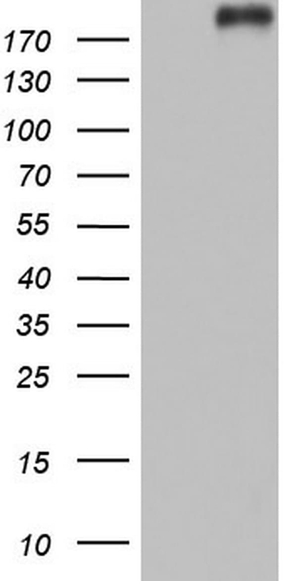 VWF / Von Willebrand Factor Antibody (aa764-1263, clone OTI8F10, Carrier-free)