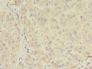 SERPIND1 / Heparin Cofactor 2 Antibody