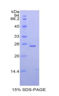 Mouse TPO / Thyroid Peroxidase Protein (Recombinant His)