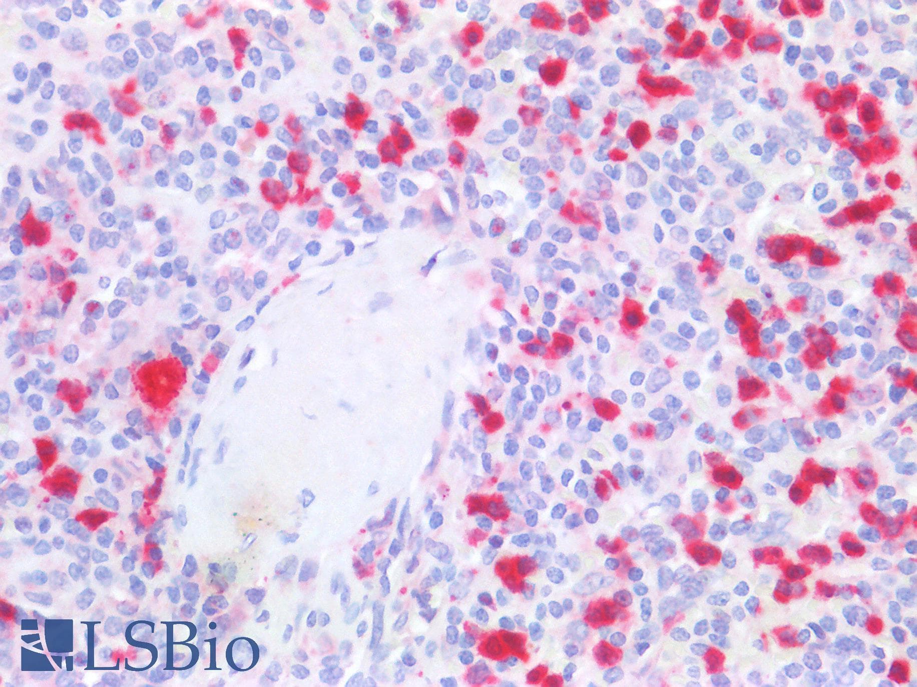 IHC-plus™ CSTA / Cystatin A Antibody