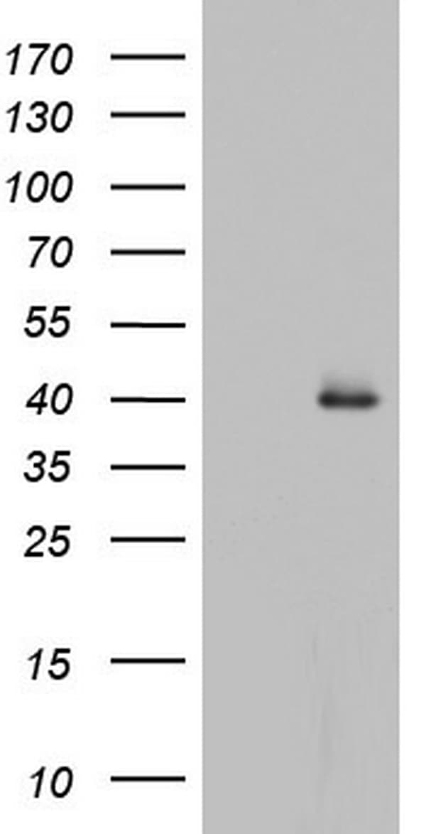 Monoclonal Mouse anti-Human HDAC11 Antibody (clone OTI2G5, WB)