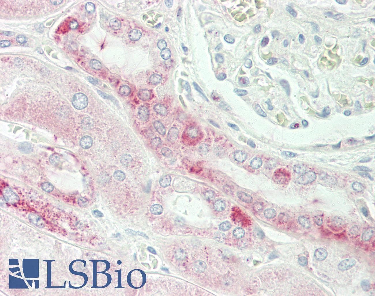 IHC-plus™ TMEM214 / FLJ20254 Antibody (aa38-66)