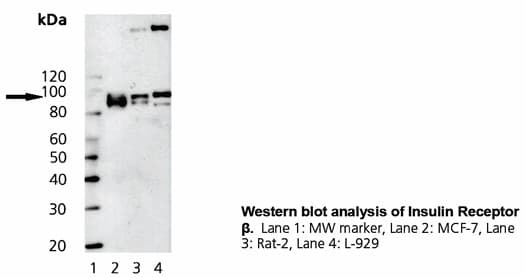 INSR / Insulin Receptor Antibody (Cytoplasmic Domain, clone C18C4)