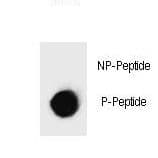 IKBKB / IKK2 / IKK Beta Antibody (phospho-Ser697)