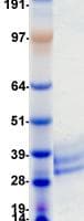 Human TNFRSF9 / 4-1BB / CD137 Protein (Recombinant DDK (Flag)-His, C-terminus)