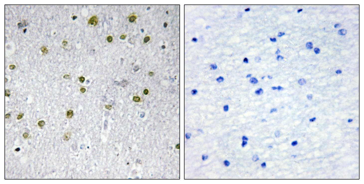 NRIP2 Antibody