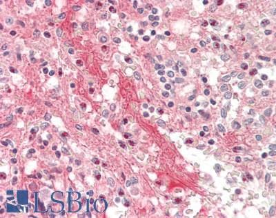 IHC-plus™ Monoclonal Mouse anti-Human HP / Haptoglobin Antibody (IHC)