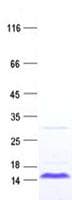 Human PAGE2B Protein (Recombinant His, N-Terminal)