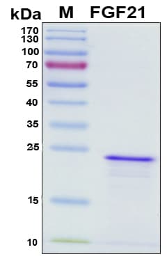 Mouse FGF21 Protein (Recombinant 6His, N-terminus)