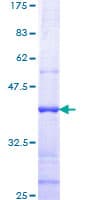 Human TMPRSS2 / Epitheliasin Protein (Recombinant GST, N-terminus)
