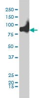 KIF2C / MCAK Antibody (clone 1G2)