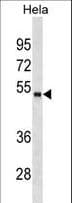 FOXA1 Antibody (aa143-171)