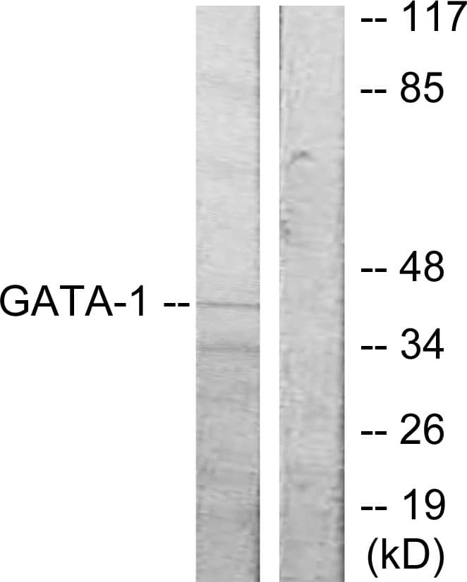 Polyclonal Rabbit anti-Human GATA1 Antibody (aa277-326, WB)