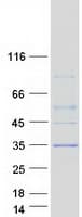 Human RASSF3 Protein (Recombinant Myc-DDK (Flag))