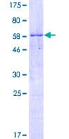 Human RPS3A / Ribosomal Protein S3A (Recombinant GST)