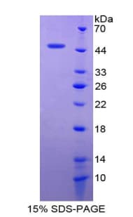 Human CLDN1 / Claudin 1 Protein (Recombinant His-GST)
