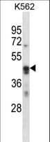 ARC / Arg3.1 Antibody (aa37-66)