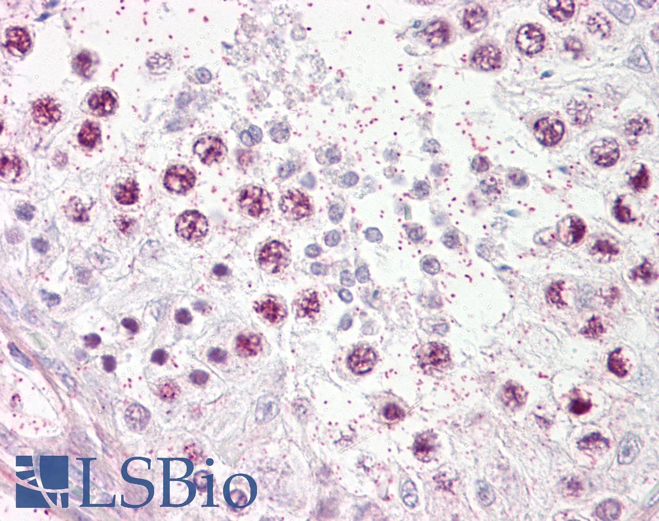 IHC-plus™ TOP2A / Topoisomerase II Alpha Antibody (aa1-50)