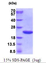 Human ppiA Protein (Recombinant His)
