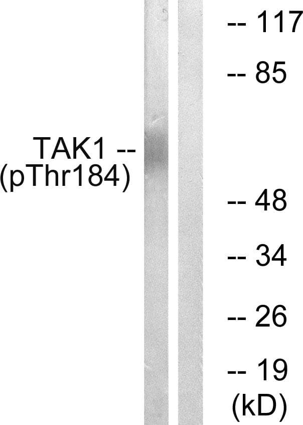 MAP3K7 / TAK1 Antibody (phospho-Thr184)