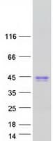 Human CA6 / Carbonic Anhydrase 6 Protein (Recombinant Myc-DDK (Flag))