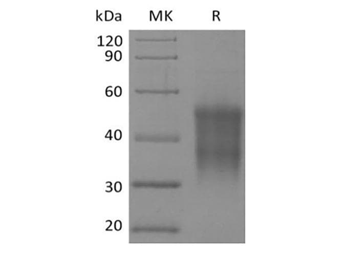 Rhesus monkey CD47 Protein (Recombinant 6His-DDK (Flag), N-terminus)