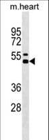 Polyclonal Rabbit anti-Mouse IL12B / IL12 p40 Antibody (aa196-222, WB)