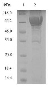 Human PCOLCE2 Protein (Recombinant 6His-SUMO, N-terminus)