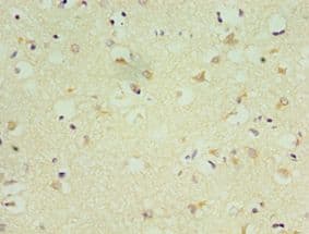 NKX2-5 Antibody (aa1-135)
