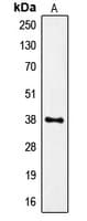 FPR1 / FPR Antibody (Internal)